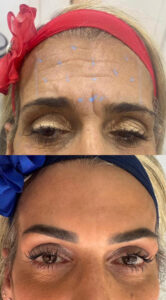 dra-samara-ramos-harmonizacao-facial-corporal-glutea-rio-de-janeiro-estetica-biomedicina.jpg1